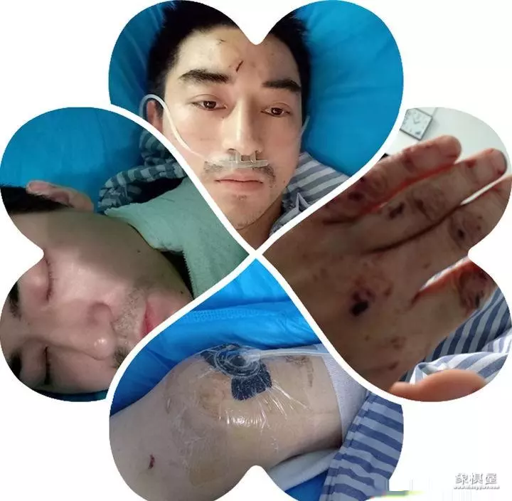 天天象棋残局刮骨疗毒