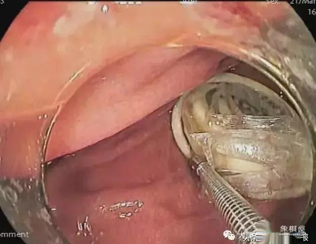 象棋中的车可以吃车吗