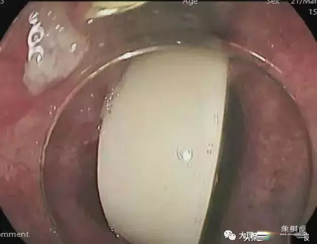 象棋中的车可以吃车吗