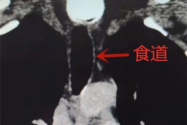 象棋中的车可以吃车吗（车轮相撞，谁能笑到最后）