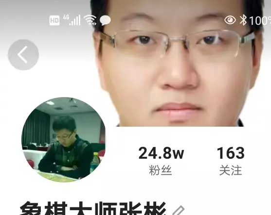 蔚强象棋大师直播在哪看(44)